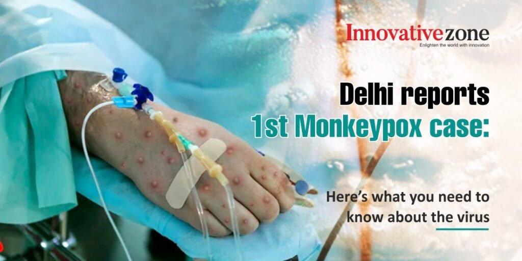 Delhi reports 1st Monkeypox case: Here’s what you need to know about the virus