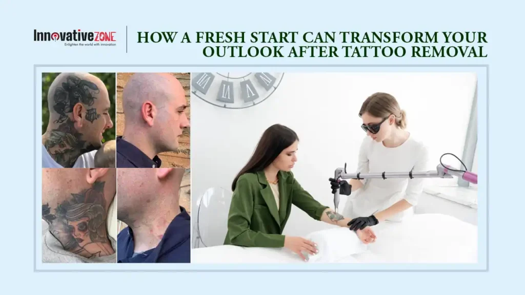 How a Fresh Start Can Transform Your Outlook After Tattoo Removal